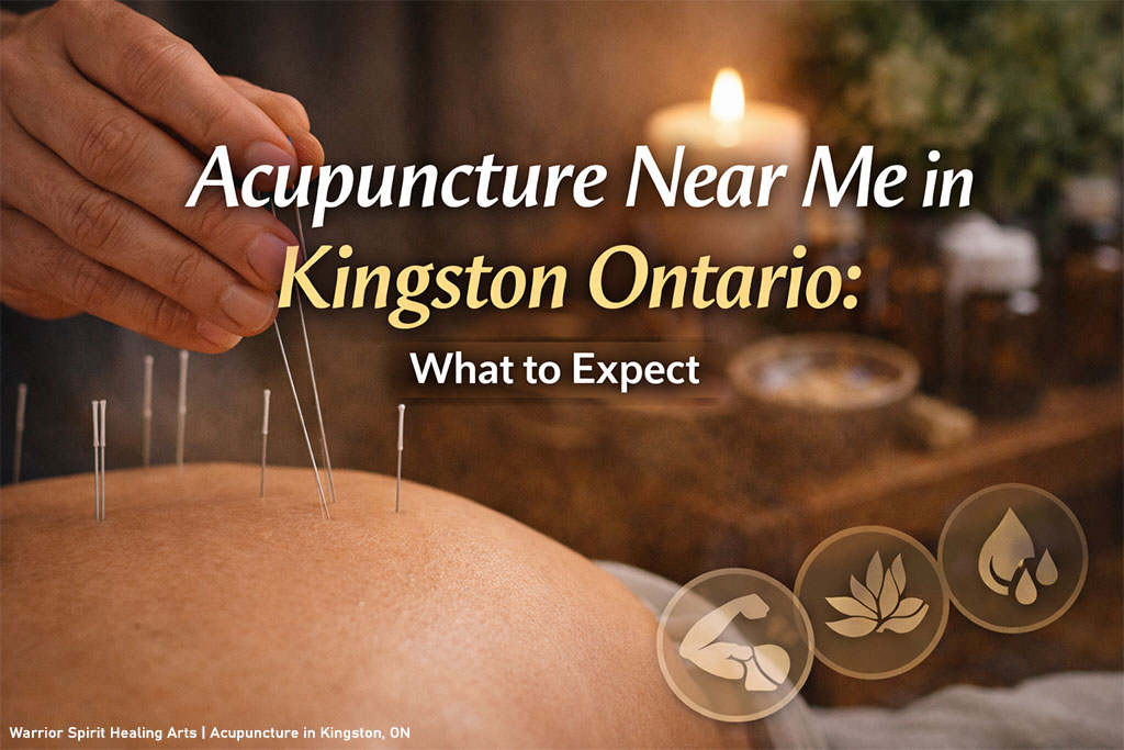 Acupuncture Near Me in Kingston Ontario: What to Expect