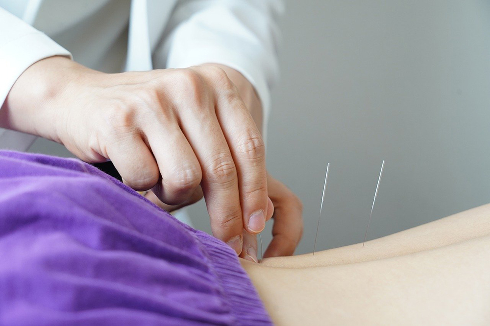 Kingston Acupuncture Benefits