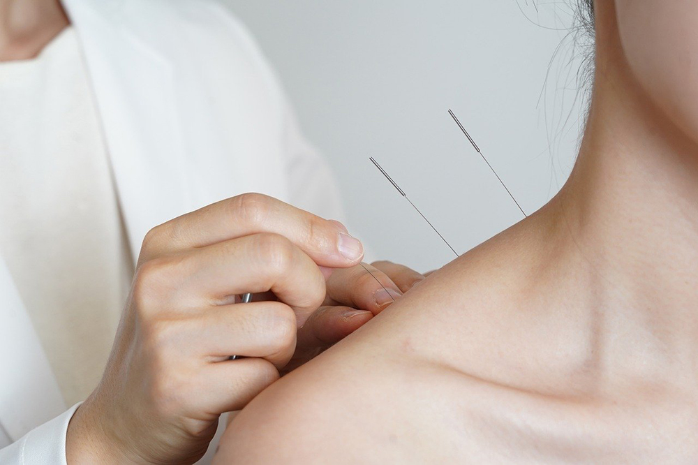 Kingston TCM & Chinese Medicine Explained