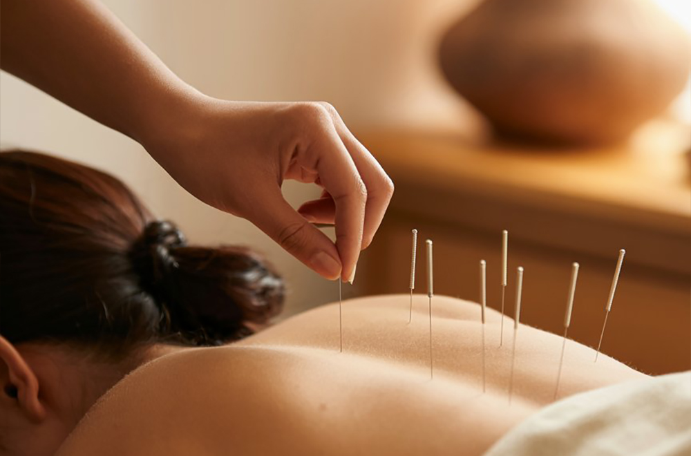 The Healing Art of Acupuncture